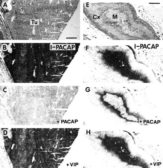 Fig. 6. PAC1 receptors in a human pheochromocytoma(A–D) and its tissue of origin, the adrenal medulla(E–H). A and E,H&E-stained sections. Tu, pheochromocytoma; Cx, cortex; M, medulla. Bars, 1 mm. B–D and G–H,autoradiograms showing 125I- PACAP binding. B and F, 125I-PACAP total binding. C and G, binding in the presence of 20 nm PACAP. D and H,binding in the presence of 20 nm VIP. 20 nmPACAP but not VIP displaces the ligand in the pheochromocytoma and in the adrenal medulla, suggesting the presence of PAC1.