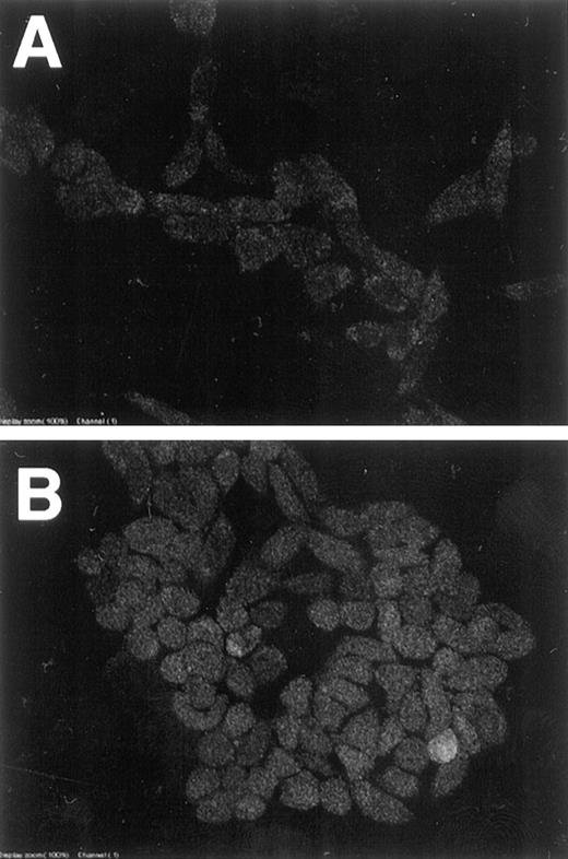 Fig. 6. GFP expression in LV(HRE)GFP-transfected A11 cells after exposure to hypoxia in vitro. A11(HRE/GFP) cells were exposed to normoxia (A) or hypoxia for 14 h followed by reoxygenation for 3 h (B). Cells were observed under a fluorescence microscope after fixation with formaldehyde.