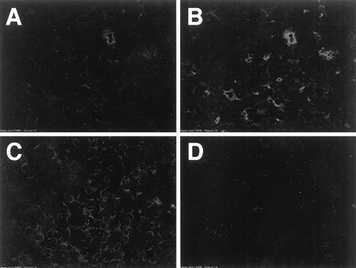 Fig. 7. GFP expression in tumors formed by LV(HRE)GFP-transfected A11 cells. A11(HRE/GFP) cells were s.c. injected into a syngeneic mouse. Ten days after the injection, the s.c. tumor was surgically removed and frozen. Cryostat sections were fixed with acetone and immunostained with rat antimouse CD31 antibody followed by TRITC-labeled goat antirat IgG. The fluorescence emitted from GFP(A and C) or TRITC (B and D) was observed under a confocal laser microscope. A slight overlapping of the emitted light was noted.