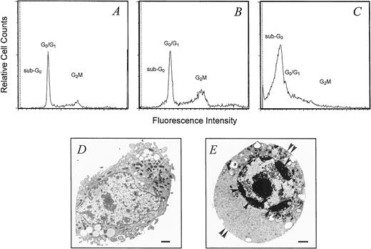 Fig. 4. Effect of AE on cell cycle dynamics determined by flow cytometry. A, DNA fluorescence flow cytometric profiles of propidium iodide-stained neuroblastoma cells before AE treatment;DNA fluorescence flow cytometric profiles of propidium iodide-stained neuroblastoma cells after 24 (B) and 48(C) h of incubation with AE. TEM analysis: D, neuroblastoma cell line in standard culture; E, neuroblastoma cells treated with AE for 48 h. Note the capping of chromatin (single-head arrows) and the loss of cell surface membrane protrusions (double-head arrows). Bars, 1 μm.