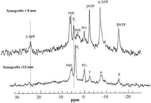 Fig. 1. Representative 31P MR spectra of melanoma xenografts grown in SCID mice. The upper spectrum was from a xenograft (≤8 mm diameter) in which necrosis was absent. The lower spectrum is from a larger xenograft (≥13 mm diameter) in which a necrotic center was present. PME,phosphomonoester; PDE, phosphodiester; PCr, phosphocreatine.