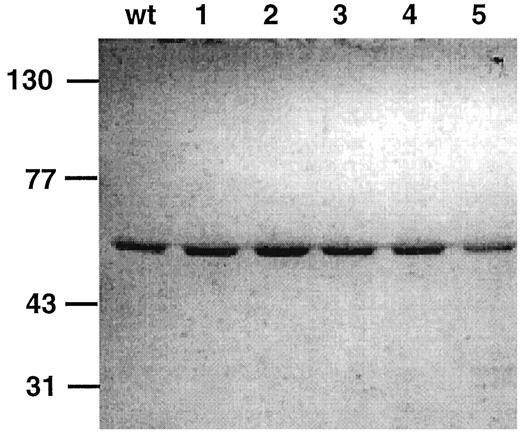 Fig. 1. SDS-polyacrylamide gel exposed to silver stain shows purified wild-type (wt) and variant(1–5) CYP1B1 proteins.