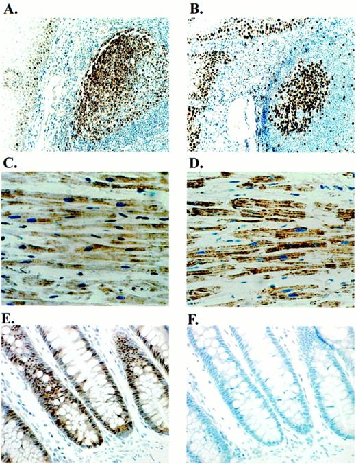 Fig. 4. Immunohistochemical localization of dUTPase in normal human tissues. A, routinely processed human tonsil stained with DUT415. All immunohistochemical staining was detected using DAB as a chromogen. B, routinely processed human tonsil stained with the proliferation marker, Ki67 (MIB-1). C, routinely processed human myocardium stained with DUT415. D, routinely processed human myocardium stained with the mitochondrial marker (Mito-M), clone 113-1. E,routinely processed human colon stained with DUT415. F,this is a serial section of the tissue observed in E. Preincubation of DUT415 with 5-fold molar excess of purified recombinant dUTPase protein abolishes staining, thereby demonstrating the specificity of this antibody.