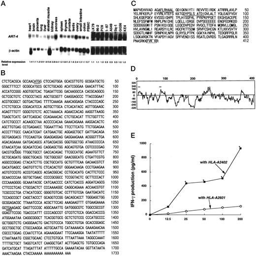Fig. 2. Characterization of the ART-4 gene. A, expression of the ART-4 gene at the mRNA level was studied by Northern blot analysis. Twenty-two tumor cell lines described in “Materials and Methods,” Bec-1, COS7, and PBMCs,and 15 normal tissues were provided for Northern blot analysis with a probe of 4E6-2B9 or β-actin as a control. Representative results are shown. Relative expression levels are also given. B, nt sequence of the ART-4 gene, 1733 bp long cloned, from the HT1376 cDNA library. The sequence of the clone 4E6-2B9 corresponds to the positions 1–1584 of the ART-4 gene. The ART-4 had an open reading frame of 1236 bp in length and encoding 412 amino acids when the first ATG (17–19, underlined in bold) and stop codon (1253–1255, double-underlined) were used for protein synthesis. There was only one nt difference, at position 708(∗), between the ART-4 of HT1376 and PBMCs (guanine in the HT1376 versus adenine in the PBMCs). These sequence data are available from EMBL/GenBank/DDBJ under accession number AB026125. C, the deduced amino acid sequence of the ART-4 protein. Underlining indicates the peptide sequences capable of inducing HLA-A24-restricted CTLs, and a box indicates an ER-retention signal. D,hydrophobicity plot (K-D plot) of ART-4 protein. Hydrophobicity was analyzed with GeneWorks Version 2.4 software (IntelliGenetics, Mountain View, CA). The two short lines above the peaks indicate the positions of the CTL-directed epitopes. E,bioactivity of the ART-4 gene. COS7 cells were transfected with various doses of the ART-4 gene and 100 ng of HLA-A2402 or control HLA-A2601cDNA, and their stimulatory effects on IFN-γ production by the GK-CTLs were tested. Values represent the means of triplicate assays. The two-tailed Student’s t test was used for the statistical analysis between the IFN-γ production by the CTLs in response to COS7 cells transfected with ART-4 and HLA-A2402 genes and that of transfected with ART-4 and HLA-A2601 genes. ∗, P < at least 0.05.