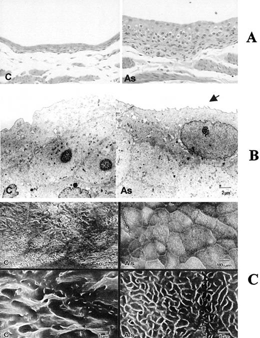 Fig. 1. Microscopic analysis of urinary bladders. A, histopathology of urinary bladder from mice given either vehicle (C) or 0.01% sodium arsenite (As) in their drinking water for 4 weeks. Full thickness bladder sections were cut, and 6-μm sections were prepared and stained with H&E. Mice treated with arsenic revealed mild transitional cell hyperplasia. The magnification is ×20. B, transmission electron microscopy of a bladder of a mouse administered either vehicle (C) or 0.01% sodium arsenite (As) in its drinking water for 4 weeks. Bladders from treated animals showed pleomorphic microvilli consistent with mild simple hyperplasia. C, scanning electron microscopy of a bladder from a mouse given either vehicle(C) or 0.01% sodium arsenite (As) in its drinking water for 4 weeks. Bladders from controls revealed flat polygonal cells of uniform size, whereas cells from treated animals had cells that were slightly raised and of variable sizes, with distinct cell borders, giving a cobblestone appearance.
