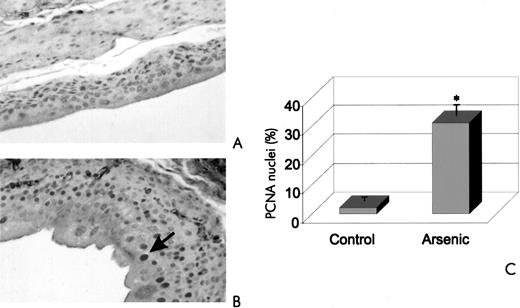 Fig. 2. PCNA immunostaining of the bladder from a control and arsenic-treated mouse. Mice were administered either control drinking water (A) or 0.01% sodium arsenite drinking water(B) for 16 weeks. Darker areas,PCNA-stained nuclei. C, data are presented as percentage of positively stained nuclei per total nuclei counted. *, significantly different from control at P < 0.05.