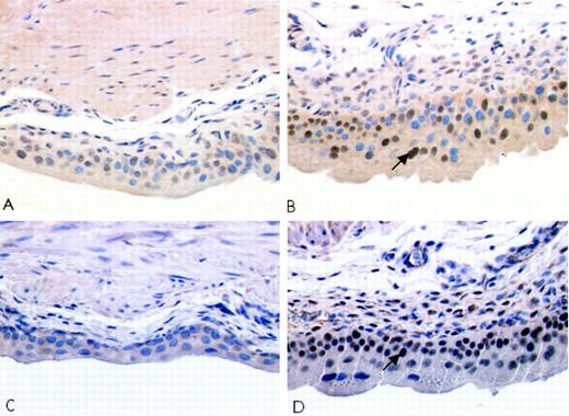 Fig. 5. Jun or Fos immunoreactivity in the urinary bladder of mice exposed to arsenic in their drinking water for 16 weeks. Bladder from control (A) or arsenic-treated (B)mice immunostained with a 1:1000 dilution of polyclonal antibodies to c-jun. Bladder from control (C) or arsenite-treated(D) mice immunostained with a 1:1000 dilution of polyclonal antibodies to c-fos. Arrows, representative positively stained cells.