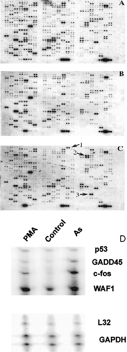 Fig. 8. Gene expression in arsenite-treated UROtsa cells as analyzed by cDNA microarray. Cells were cultured in the presence of vehicle (A), 10 μm sodium arsenite(B), or 50 μm sodium arsenite(C) for 2 h. 32P-Labeled cDNA probes generated from poly(A)+ RNA were hybridized to cDNA microarrays as described in “Materials and Methods.” Arrows in C represent c-fos (arrow 1), GADD153 (arrow 2), and EGR-1 (arrow 3). Relative changes in gene expression were determined by normalizing the hybridization signals to the signals obtained from the housekeeping genes included with the cDNA array. RNase protection assay was conducted on RNA, isolated from UROtsa cells treated with sodium arsenite (50 μm) or PMA (20 ng/ml) for 2 h(D).