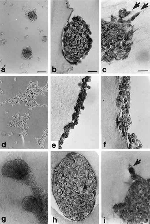 Fig. 2. Three-dimensional culture model; a combined assay for tumor cell motility and invasion. Single cell suspensions of C-100 cells were plated onto MG matrix or EHS tumor matrix substratum. Single cell aggregation into organoids was monitored, and organoids were harvested at 72 and 120 h after plating. Organoids formed on EHS tumor matrix substratum (a–c). a,72 h, ×100, bar = 10 μm; b, 72 h, 5-μm H&E-stained section, ×400, bar = 25 μm; c, 120 h, 5-μm H&E-stained section, ×400, bar = 25 μm. Organoids formed on nulliparous MG matrix substratum(d−f). d, 72 h,×100; e, 72 h, 5-μm H&E-stained section, ×400; f, 120 h, 5-μm H&E-stained section, ×400. Organoids formed on involution MG matrix substratum(g−i). g, 72 h,×100; h, 72 h, 5-μm H&E-stained section, ×400; i, 120 h, 5-μm-stained H&E section, ×400. Arrows, invasive growth cones.