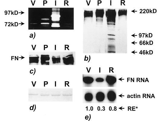 Fig. 3. Biochemical characterization of MG matrix and tissue. a, substrate gel analysis for detecting gelatinase activity in isolated mammary matrix preparations loaded by equal protein concentration. Lane V, nulliparous MG matrix; Lane P, mid-pregnancy MG matrix; Lane I,involution MG matrix; Lane R, parous, fully regressed MG matrix. b, Western analysis of FN protein in isolated MG matrix preparations loaded by equal wet weight isolation. c, Western analysis of FN protein in isolated MG matrix preparations loaded by equal protein concentration. d,Ponceau-stained gel of c and representative of a. Both batches of mammary matrices were analyzed by zymography and Western analyses; representative data are shown. e, FN mRNA levels in rat mammary tissue. Lane V, nulliparous MG matrix; Lane I, day 2–4-day postlactation involution MG matrix; Lane R, fully regressed rat MG RNA. Actin served as an internal loading control. FN RNA relative expression levels(RE*), were normalized to actin, as determined by scanning densitometry.