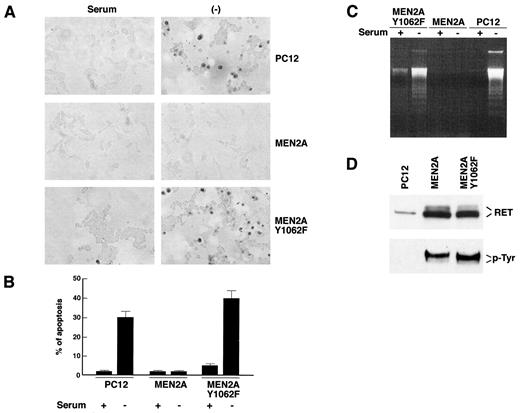 Fig. 1. A, the indicated PC12 cell lines were maintained for 12 h in the presence (serum) or absence (−) of serum and subjected to the TUNEL reaction. Representative fields are shown; dark cells are the apoptotic TUNEL-positive ones. B, the percentages of apoptotic nuclei were calculated by counting a minimum of 200 cells in 10 randomly selected fields of each specimen; the average results of three independent experiments are reported. Variations between single experiments were <20% of the mean; bars, SD. C, soluble DNA was extracted from cells (2 × 106) starved for 12 h and run on a 1.5% agarose gel; the experiment shown here is representative of three independent assays. D, 500 μg of protein lysates were immunoprecipitated with anti-RET, and the immunoblot was stained with anti-phosphotyrosine (anti-pTyr) or anti-RET antibodies.