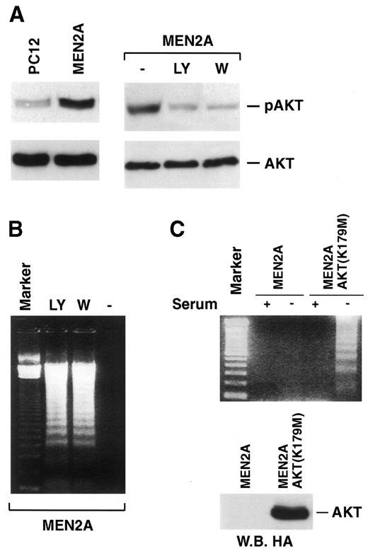 Fig. 2. A, protein lysates (50 μg) from the indicated cell lines, maintained for 12 h (when indicated) in the presence of 50 nm wortmannin (W) or 10μ m LY294002 (LY), were immunoblotted with anti-phospho-Akt (upper panel) or anti-Akt (lower panel) antibodies. B, PC12 MEN2A cells were maintained for 12 h in serum-free medium in the presence of 50 nm wortmannin (W) or 10 μmLY294002 (LY), as indicated. Soluble DNA was analyzed by agarose gel electrophoresis. C, PC12 MEN2A cells were transiently transfected with HA-AKT(K179 M) or with the empty vector;after 24 h, cells were kept for an additional 18 h in the presence or absence of serum, and DNA laddering was analyzed by electrophoresis. Western blot with anti-HA antibodies (100 μg of protein lysate) confirmed the expression of the Akt(K179 M) protein.