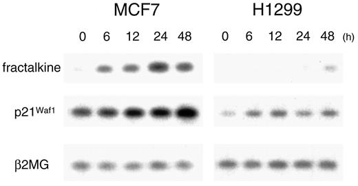 Fig. 5. p53-dependent induction of fractalkinetranscription after DNA damage by gamma radiation. Expression of the β2 MG gene was used as a quantity control in RT-PCR experiments to measure induction of fractalkine and p21Waf1. MCF7 cells contain wild-type p53. H1299 cells lack wild-type p53.