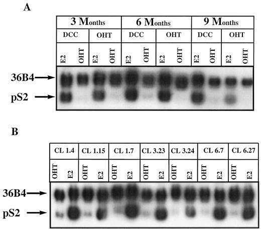 Fig. 3. Induction of pS2 in MVLN cells and clones isolated from cells treated with OHT. A, MVLN cells that had grown for 3, 6, and 9 months in DCC medium alone or in DCC medium containing 10−7 m OHT were treated as described in “Materials and Methods” with either 10−9m estradiol (E2) or 10−7m OHT. Total RNA was then isolated and processed for Northern blot analysis using a pS2 probe as described in “Materials and Methods.” B, various clones were isolated from MVLN cells treated with 10−7 m OHT for 1 month(CL 1.4, CL 1.15, and CL 1.7), 3 months(CL 3.23 and CL 3.24), and 6 months(CL 6.7 and CL 6.27). Each of these clones was analyzed as in A.