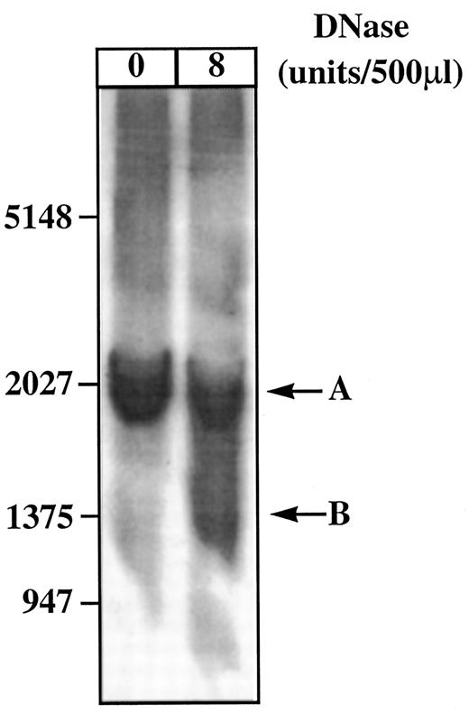 Fig. 6. Localization of the DNase I hypersensitivity sites of the insert containing pVit-tk-Luc copies in MVLN cells. Forty μg of DNA obtained from MVLN cell nuclei stimulated by estradiol were digested or not with 8 units/500 μl of DNase I, as indicated abovethe autoradiograph, and then extracted by phenol-chloroform and cleaved by ApaLI + BanII restriction endonucleases (3 units/μg of DNA). The digestion products were analyzed by Southern blotting on a 0.8%agarose gel and probed with P1.