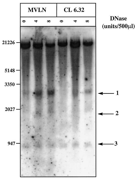 Fig. 7. DNase I hypersensitivity sites contained in the promoter part of the PR gene in MVLN cells and clone CL 6.32. Treatment and DNase I digestion of MVLN cell nuclei were performed as described in Fig. 5<$REFLINK>. A 10−9 m estradiol treatment was performed 2 h before nucleus isolation. The amount of DNase I is indicated in the top part (units/500μl). Southern blotted DNA was hybridized with a 625-bp PCR probe amplified between oligonucleotides D4 and D5 (Fig. 4<$REFLINK>A). Arrows, DNase I hypersensitivity sites.