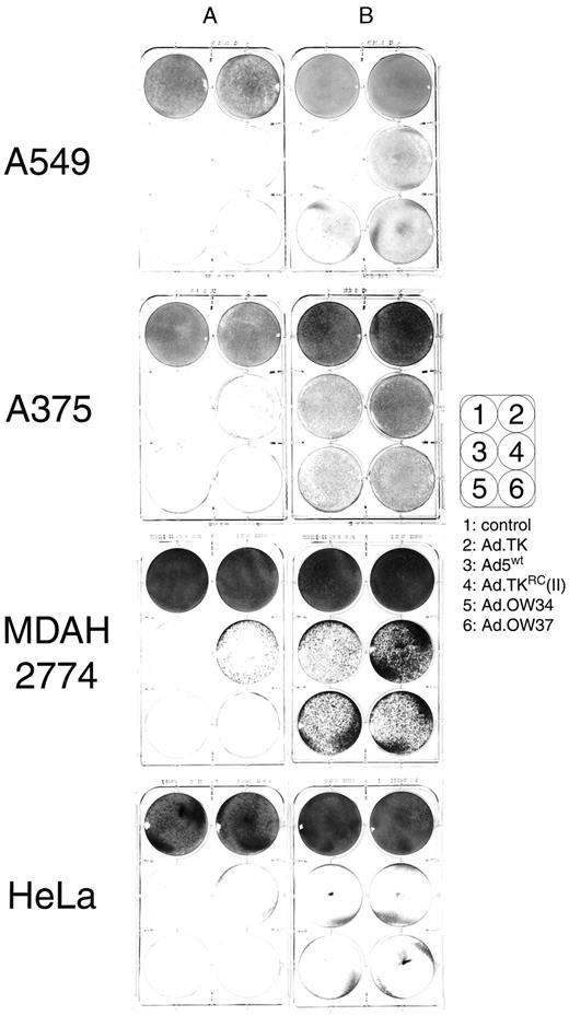 Fig. 2. CPE assay. Subconfluent (A) and confluent(B) cell monolayers were infected with indicated viruses at an MOI of 1 pfu/cell. Five days later, the cells were washed and stained.