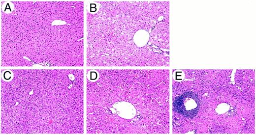 Fig. 7. Histopathological responses in liver of C57BL/6 mice 48 h after a single i.v. injection of 1 × 1011 particles of Ad5wt (B),Ad.TK (C), Ad.TKRC(II) (D),and Ad.OW34 (E). A, liver samples from mice inoculated with virus-free diluent served as the control. H&E;original magnification, ×10.