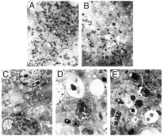 Fig. 8. TEM of C57BL/6 mice livers 48 h after i.v. inoculation of 1 × 1011 particles of Ad5wt (B), Ad.TK (C),Ad.TKRC(II) (D), and Ad. OW34(E). A, liver of mice injected with virus-free diluent served as the control. Original magnification,×7020.