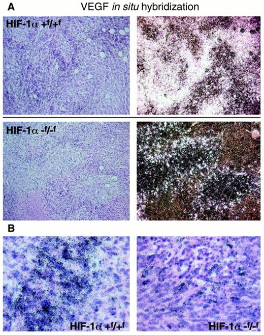Fig. 4. Absence of HIF-1α affects VEGF expression within a tumor. In situ hybridization demonstrating the punctate pattern of VEGF expression in −f/−fras/TAg tumors. A, dark-field view at a magnification of ×100 (right), alongside a bright-field image of the same region. Exposure times for the dark-field photos were identical. B, bright-field view at a higher magnification (×400). Black dots are exposed silver grains.