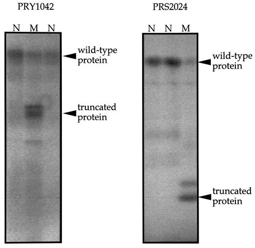 Fig. 1. The protein truncation test performed for BRCA2. a, analysis of PTT fragment 4 in affected individual 201 from family PRY1042 shows a truncated mutant protein (M)compared with only wild-type protein detected in two normal samples (N). b, analysis of affected individual 201 from family PRS2024 shows a truncated mutant protein(M) compared with only wild-type protein detected in two normal samples (N).