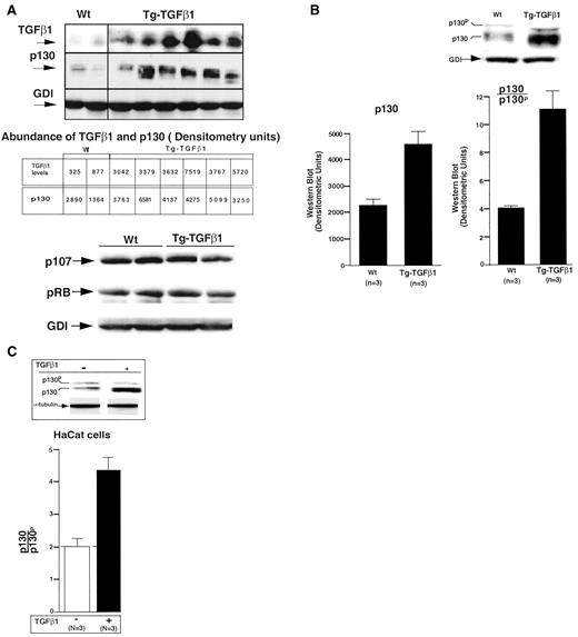 Fig. 1. Increased p130 abundance in Tg-TGF-β1 livers. A: upper panel, Western blot analysis of the Wt and Tg-TGF-β1 livers with p130 antibody (C-20; from Santa Cruz Biotechnology) and TGFβ antibody demonstrated increased abundance of TGFβ and p130 in the Tg-TGFβ1 livers compared with Wt mice. Densitometric analysis of p130 Western blot analysis from Wt and Tg-TGFβ1 livers and is shown normalized for loading with GDI. Lower panel, Western blot analysis for p107 and pRB or GDI from Wt or Tg-TGF-β1 livers (B). Densitometric analysis of p130 Western blotting was used to determine the ratios of phosphorylated and hypophosphorylated p130, using anti-Rb2 mAb from Transduction Laboratories, shown as the mean of three separate animals; bars, SEM. The results are from three animals with higher TGFβ levels. C, HaCaT keratinocytes were treated with TGF-β1 for 24 h, and the relative abundance of phosphorylated and hypophosphorylated p130 was assessed and shown graphically as a ratio of unphosphorylated and phosphorylated p130. Bars, SEM.