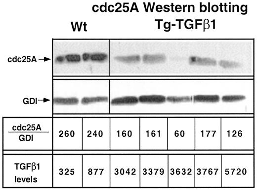 Fig. 3. Tg-TGF-β1 inhibition of cdc25A in vivo.Cdc25A Western blot analysis of Wt or Tg-TGF-β1 livers is shown with corresponding TGF-β1 levels determined by Western blotting. The data are shown for each animal with relative abundance normalized for loading and transfer using the GDI antibody as described in“Materials and Methods.” The cdc25A levels of two Wt and six Tg-TGF-β1 mice are shown.