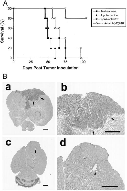 Fig. 4. A, treatment of intracranial U373-MG tumors with 2-5A-anti-hTER. Mice were intracranially inoculated with 5 × 105 U373-MG cells [10 μl of a tumor cell suspension of 5 × 107/ml in serum-free DMEM (0.5 ml) and Matrigel (0.5 ml)] on day 0. On days 14, 16, 18, 21,and 23, mice (n = 5) received direct intracranial injections of spA4-anti-hTER or spA4-anti-(M6)hTER (3.0 nmol/10 μl distilled water/1.0μl Lipofectamine). As controls, no-treatment or Lipofectamine (1.0μl/10 μl distilled water)-alone groups were prepared. B, H&E staining of brain tissues of BALB/c nude mice with intracranial U373-MG tumors. For histological analysis, mice were killed by cervical dislocation after the treatment, and the brains were removed and snap-frozen in liquid nitrogen. Treatment with Lipofectamine alone (a and b, day 56) or with spA4-anti-hTER and Lipofectamine (c and d, day 110). b and d are a higher magnification of a and c,respectively. Arrows (a, b), tumors; arrowhead (c, d), the site of treatment. Bars, 1.0 mm.