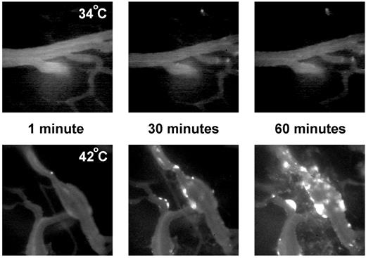 Fig. 1. Extravasation of 100-nm liposomes from tumor vessels at 34°C and 42°C at 1, 30, and 60 min after injection. Minimal extravasation of liposomes was seen at 34°C throughout the 60-min experiment (top panel). At 42°C, focal perivascular fluorescent spots developed that increased in size and became more diffuse over time (bottom panel).