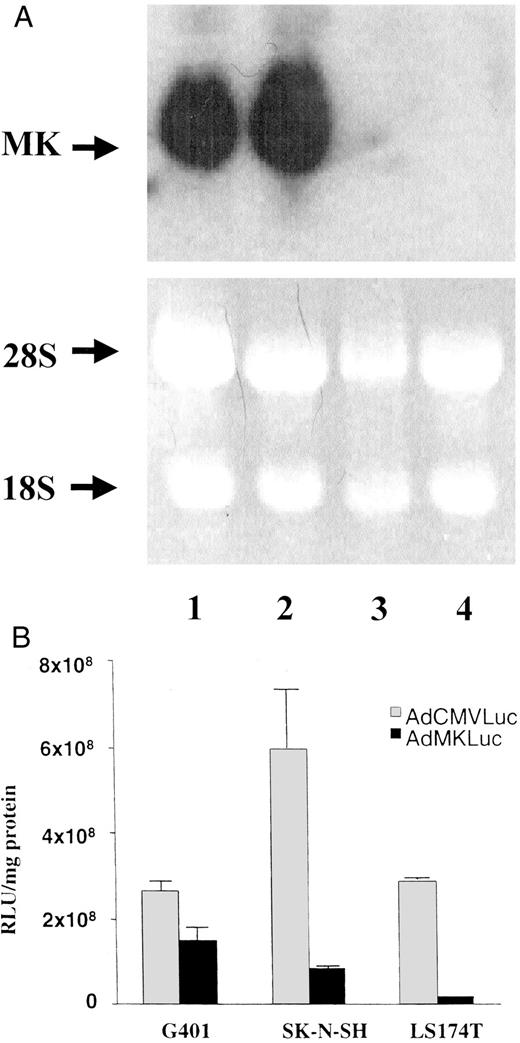 Fig. 1. A, MK mRNA expression in cell lines. The arrow of the upper panel shows MK mRNA. The lower lane shows 18S and 28S rRNA stained by ethidium bromide. Each lane contains 20 μg of total RNA. Lane 1, G-401; Lane 2, SK-N-SH; Lane 3, LS174T; Lane 4, Daudi cell line. B, luciferase inducement in cell lines by AdMKLuc or AdCMVLuc. The means of the luciferase inducement by AdCMVLuc are 2.6 × 108 RLU/mg protein in G-401,5.9 × 108 RLU/mg protein in SK-N-SH, and 2.9 × 108 RLU/mg protein in LS174T. On the other hand, those by AdMKLuc are 1.5 × 108RLU/mg protein in G-401, 8.5 × 107 RLU/mg protein in SK-N-SH, and 1.7 × 107 RLU/mg protein in LS174T.