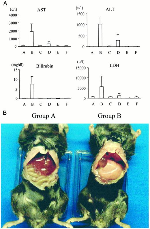 Fig. 5. A, serum levels of AST, ALT, total bilirubin, and LDH after AdHSVtk/GCV treatment. Mice received 1 × 109 pfu of AdMKTK or AdCMVTK via tail injection. Blood samples were obtained after a 7-day GCV treatment (2 × 50 mg/kg per day). Group A,AdMKTK + GCV treatment (n = 4);group B, AdCMVTK + GCV treatment(n = 5); group C, AdMKTK(n = 4); group D, AdCMVTK(n = 4); group E, GCV treatment (n = 4); group F, no treatment (n = 4). B, macroscopic findings of the livers of mice treated with either AdMKTK/GCV (group A) or AdCMVTK/GCV (group B).