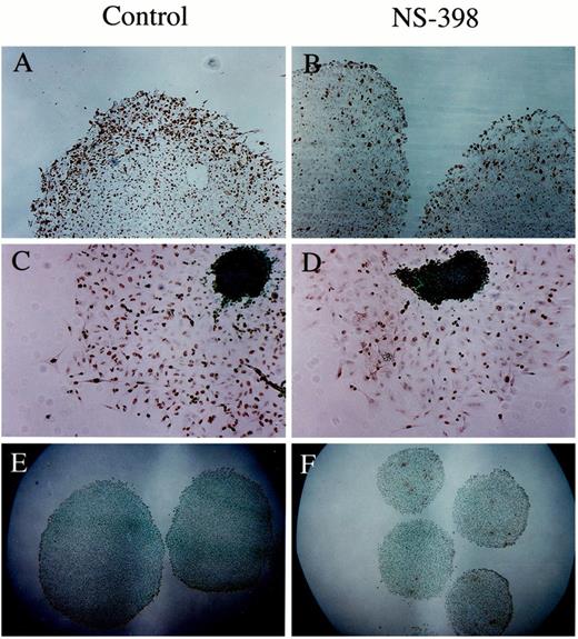 Fig. 4. Photomicrographs using immunohistochemical staining for Ki-67 staining (A–D) and for DNA fragmentation using terminal deoxynucleotidyl transferase-mediated nick end labeling staining (E and F) using the U-87MG human glioma cell line. Cross-section through a control spheroid with a highly proliferative outer layer (A) and NS-398-treated spheroid (B; ×100). Migrating tumor cells in the control group (C) and NS-398 treatment group(D; ×100). Apoptosis in spheroids treated with NS-398(F) compared with control (E; ×40).