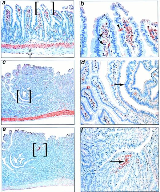 Fig. 2. Immunohistochemical localization of COX-1 and COX-2 in normal and neoplastic tissue. a and b,low (×50) and high (×150) power images of a section of normal small intestine from a 6-month-old Min/+ mouse stained with antibody to COX-1. Immunolocalization was seen in the cells of the lamina propria (closed arrows), inner muscular layer(open arrow), and occasional villous epithelial cell(arrowhead). c and d, low(×25) and high (×150) power images of an intestinal adenoma from a 6-month-old Min/+ mouse stained with antibody to COX-1. At low magnification, the tumor lacks COX-1 immunoreactivity relative to the adjacent lamina propria and underlying muscularis. Higher magnification (d) of the bracketed areain (c) shows unstained neoplastic epithelial cells(arrow) adjacent to positive normal mucosa. e and f, low (×25) and high (×150)power images of the same tumor in c and dstained with an antibody to COX-2. Tumor and adjacent normal tissue are negative for COX-2 protein except for a small focus (in brackets, e), which on higher magnification(f) is composed of a cluster of positive-staining lamina propria cells.