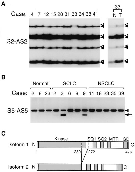 Fig. 1. SSCP and agarose gel electrophoresis analysis of RT-PCR products of CHK1. A, RT-PCR-SSCP analysis showing distinct mobility shifts in both normal and lung tumor specimens of case 33. This germ-line amino acid substitution (valine to isoleucine at codon 46) was unique to this case among a total of 169 individuals. B, detection of a SCLC-selective,tumor-predominant expression of previously undescribed CHK1 isoform. C, the shorter CHK1 isoform, which lacks the carboxyl portion of the kinase domain, is shown schematically at the bottom.