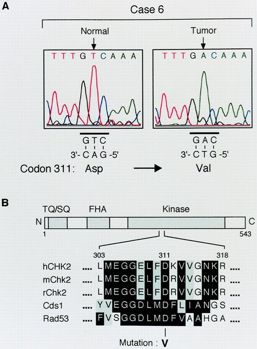 Fig. 3. Sequence analysis (A) and mapped location(B) of an in vivo somatic mutation of CHK2 in case 6. The identified in vivosomatic mutation substitutes valine for an evolutionarily conserved aspartic acid at codon 311 within the kinase domain.