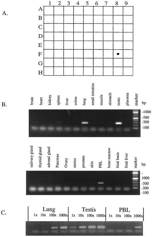 Fig. 1. Specific expression of XAGE-1. A, RNA dot blot hybridization. Human multiple tissue master blot with 76 tissue-specific poly(A) RNA (Clontech) were hybridized with XAGE-specific probe. A1, whole brain; B1, cerebral cortex; C1, frontal lobe; D1, parietal lobe; E1, occipital lobe; F1, temporal lobe; G1, p.g. of cerebral cortex; H1, pons; A2,cerebellum left; B2, cerebellum right; C2, corpus callosum; D2, amygdala; E2, caudate nucleus; F2, hippocampus; G2, medulla oblongata; H2, putamen; A3, substantia; B3, nucleus accumbens; C3, thalamus; D3, pituitary gland; E3, spinal cord; A4, heart; B4, aorta; C4, atrium left; D4, atrium right; E4, ventricle left, F4, ventricle right; G4, interventricular septum; H4, apex of the heart; A5,esophagus; B5, stomach; C5, duodenum; D5, jejunum; E5, ileum; F5, ileoceum; G5, appendix; H5, colon ascending; A6, colon transverse; B6, colon descending; C6,colon rectum; A7, kidney; B7, skeletal muscle; C7, spleen; D7, thymus; E7, PBLs; F7, lymph node; G7, bone marrow; H7, trachea; A8, lung; B8, placenta; C8, bladder; D8, uterus; E8, prostate; F8, testis; G8, ovary; A9, liver; B9,pancreas; C9, adrenal gland; D9, thyroid,gland; E9, salivary gland; F9, mammary gland. B, RT-PCR analysis. Twenty-four different sources of cDNA (Origene) were amplified by using primers xa-1 and xa-2 under the conditions described in “Materials and Methods.” After the PCR cycles, 5 μl of 25 μl of the high-concentration (1000×)reactions were analyzed in agarose gel and visualized by staining with ethidium bromide. C, four different concentrations from lung, testis, and PBLs amplified in A were run together to compare the relative level of XAGE-1expression. F3–H3, D6–H6, H8, G9, and H9 are empty.