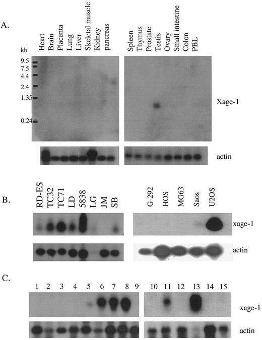 Fig. 2. Northern blot analysis of the XAGE-1 gene. A, Northern blot (Clontech) of 16 different normal tissues probed separately with xage-1 and actin probe. B, the expression of XAGE-1 in Ewing’s sarcoma cell lines (left panel) and osteosarcoma cell lines (right panel). C, the expression of XAGE-1 in patient tumor samples. Lanes1–9, Ewing’s sarcoma patients; Lane10, normal muscle; Lane11, alveolar rhabdomyosarcoma; Lane12, fetal muscle; Lanes13–15, embryonal rhabdomyosarcoma. Total RNA was probed separately with xage-1 probe and actin probe.