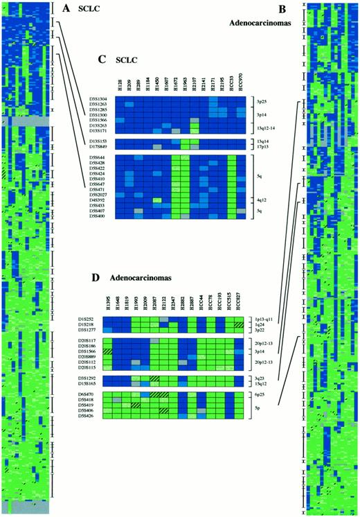 Fig. 4. Cluster analysis of microsatellite markers in SCLCs(A and C) and adenocarcinomas(B and D). A and B, complete clustering results for all markers. Vertical bars, regions with >75% concordance. C and D, magnification of the most significant regions showing concordances between markers mapping to different chromosomes. Top, cell lines; left, markers; right, chromosomal locations. Color codes: dark blue box, LOH; dark green box, HET; gray box, NI; light blue box, partially informative (LOH); light green box, partially informative (HET); hatched boxes,MA.