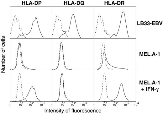 Fig. 1. Expression of HLA class II molecules on the melanoma clonal line MEL.A-1. LB33-EBV is an EBV-transformed B-cell line derived from blood lymphocytes of patient LB33. MEL.A-1 is a clonal subline of the melanoma line MEL.A, which is derived from a metastasis resected from patient LB33 in 1988. The melanoma cells were cultured over 2 days with and without IFN-γ (50 units/ml), incubated with mouse monoclonal antibodies Leu-10 (anti-HLA-DQ), L243 (anti-HLA-DR), and B7/21 (anti-HLA-DP), washed, and labeled with goat antimouse immunoglobulin antibodies coupled to fluorescein. Dashed lines, labeling with the anti-immunoglobulin antibodies alone.