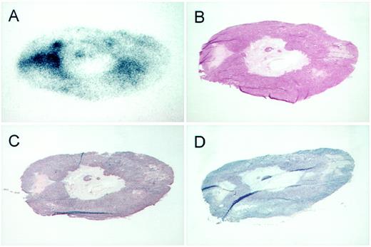 Fig. 5. Distribution of 125I/111In radiolabeled hu3S193 in an MCF-7 tumor xenograft 120 h after antibody injection as determined by autoradiography (A). Localization of radiolabel is compared with the location of viable tumor cells by H&E staining (B) and to antigen distribution as shown by immunohistochemistry (C). D is a control slide for antigen detection in which huA33 was applied as the primary antibody instead of hu3S193, and negligible staining was noted.
