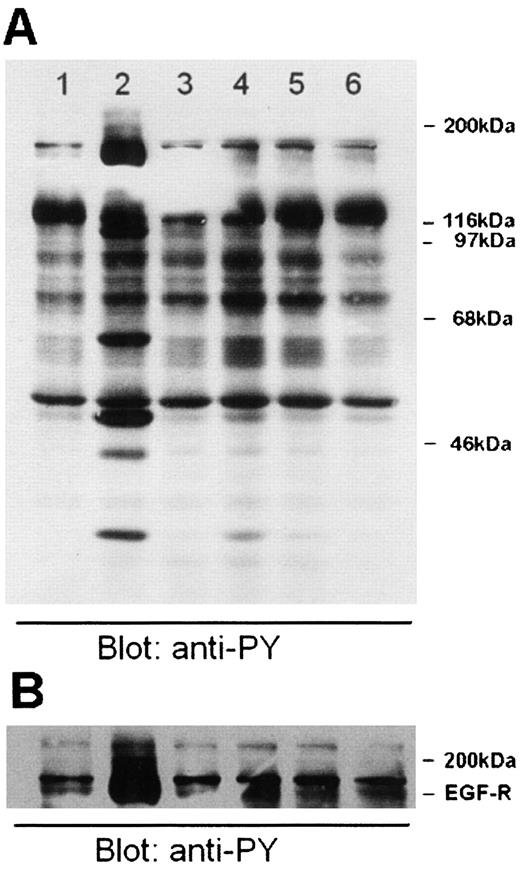 Fig. 1. OVCA 433 cells were stimulated for 5 min with 10 ng/ml hrEGF (Lanes 2 and 3) or with 20 nm ET-1 (Lanes 4-6) after 15 or 30 min pretreatment with tyrphostin AG1478 (Lanes 3and 5) or BQ123 (Lane 6), respectively. Cells were then lysed, and 40 μl of total cell extracts were electrophoresed on 7.5% gels by SDS-PAGE, followed by Western blot analysis with antiphosphotyrosine monoclonal Ab [clone 4D10(A)]. A longer time exposure of the same blot shows a 170-kDa band corresponding to EGF-R (B).