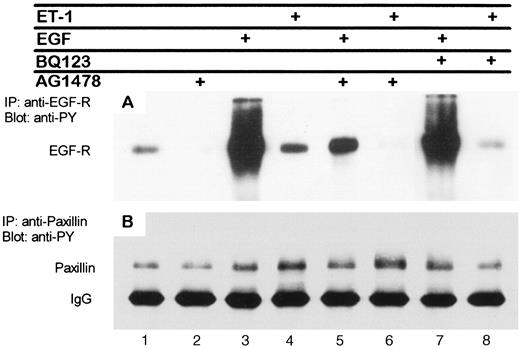 Fig. 2. Serum-starved cells (Lane 1) were preincubated for 15 or 30 min with tyrphostin AG1478 (Lanes 2, 5, and 6) or BQ123(Lanes 7 and 8), respectively, and then were stimulated for 5 min with 10 ng/ml hrEGF (Lanes 3, 5, and 7) or 20 nm ET-1(Lanes 4, 6, and 8). Cells were then lysed, and cell lysates were divided into aliquots and immunoprecipitated with monoclonal Abs to EGF-R (A) or paxillin (B). Imunoprecipitates were analyzed by SDS-PAGE on 7.5% gels followed by Western blot analysis with antiphosphotyrosine monoclonal Ab (clone 4D10). The lower, more intense, band in B represents cross-reactivity of the secondary Ab with anti-paxillin IgG.