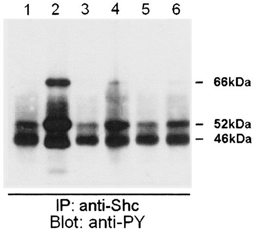 Fig. 3. OVCA 433 cells were serum-starved for 24 h(Lane 1), preincubated with tyrphostin AG1478(Lanes 3 and 5) or BQ123 (Lane 6), and then stimulated with 10 ng/ml hrEGF (Lanes 2 and 3) or 20 nm ET-1 (Lanes 4-6). Cells were then lysed, and cell extracts were immunoprecipitated with rabbit polyclonal Ab to Shc. Immunoprecipitates were analyzed by SDS-PAGE on 7.5% gels, followed by Western blot analysis with antiphosphotyrosine monoclonal Ab (clone 4D10).