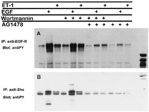 Fig. F10-0006. OVCA 433 cells were stimulated for 5 min with 20 nm ET-1 or 10 ng/ml hrEGF in the absence or presence of 125 nm tyrphostin AG1478, 80 nm wortmannin, or both, and then were lysed and immunoprecipitated with anti-EGF-R or anti-Shc Abs. Immunoprecipitates were run on SDS-PAGE 7.5% acrylamide gels and immunoblotted with antiphosphotyrosine monoclonal Abs. Molecular weight markers were present in the last Lane on the right.
