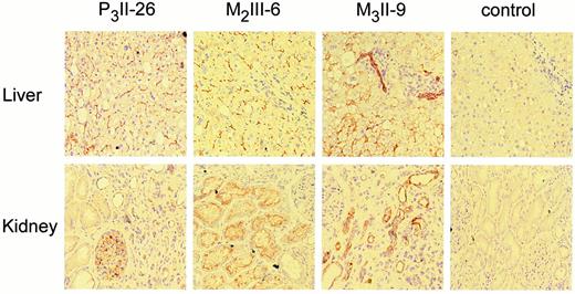 Fig. 4. Staining of frozen sections of normal human liver(upper panel) and kidney (lower panel)with P3II-26, M2III-6, M3II-9, and control Mabs. P3II-26 and M2III-6 show that both MDR3 P-gp and MRP2 are present in the canalicular membranes of the hepatocytes, whereas M3II-9 shows that MRP3 is present in the bile ducts and the basolateral membranes of the hepatocytes. In kidney, P3II-26 shows the presence of MDR3 P-gp in the glomeruli, M2III-6 shows the presence of MRP2 in the apical membrane of the proximal tubules, and M3II-9 shows the presence of MRP3 in the thinner tubules, most likely the loops of Henle and/or the collecting tubules. Slides were stained with HRP-labeled rabbit-antimouse, FITC-labeled tyramine, HRP-labeled rabbit-anti-FITC,and amino-ethyl-carbazole.