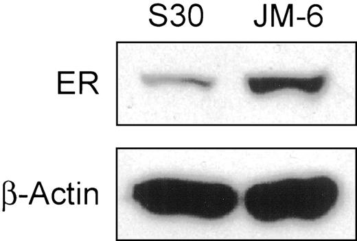 Fig. 2. Western blot screen of ER protein expression in MDA-MB-231 cells stably expressing D351 (S30) or D351G(JM-6). Western blot analysis was performed as described in “Materials and Methods.” β-actin protein was measured to ensure even loading. Western blot is representative of three independent experiments.