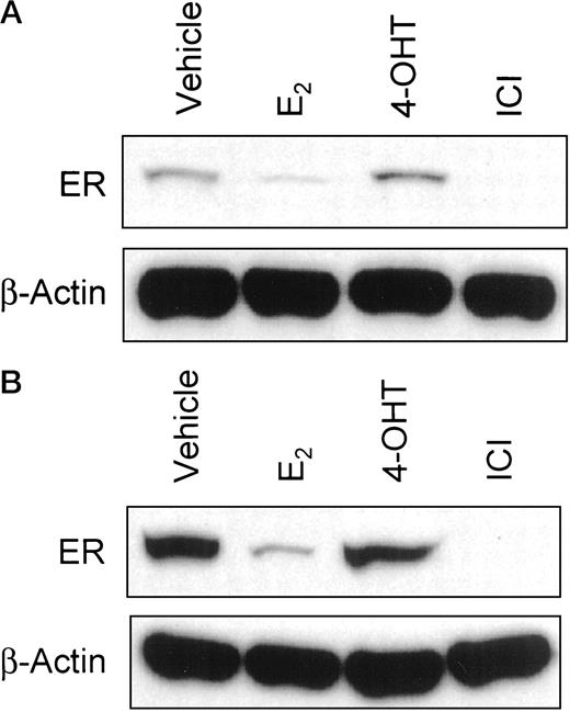 Fig. 3. Western blot screen of ER protein expression in MDA-MB-231 cells stably expressing D351 (S30; A) or D351G (JM-6; B). Cells were treated for 24 h with vehicle (ethanol), 10−9 mE2, 10−7 m 4-OHT, or 10−7 m ICI 182,780. Western blot analysis was performed as described in “Materials and Methods.” β-actin protein was measured to ensure even loading. Western blots are representative of four independent experiments.