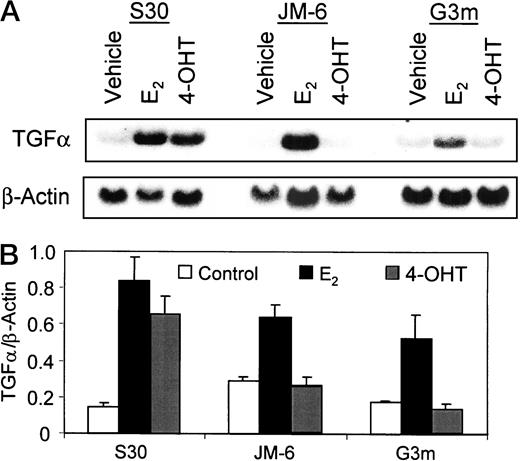Fig. F10-0060. A, Northern blot analysis of TGFαmRNA in S30, JM-6 cells, and G3m cells treated with E2 or 4-OHT. S30, JM-6 cells, and G3m grown in E2-free stripped media were treated for 24 h with vehicle (ethanol),10−9 m E2, 10−7m 4-OHT. Northern blot analysis of total RNA was performed using TGFα cDNA probe as described in “Materials and Methods.”β-actin mRNA was measured to ensure even loading. Northern blot is representative of three independent experiments. The combined data set is illustrated in the histogram, and the response of each clone is to E2 and 4-OHT, analyzed by Student’s t test. The difference between control and E2 was significant in S30 (P < 0.05) and JM-6(P < 0.05); the difference between control and E2 in G3m was not significant(P = 0.1). The difference between control and 4-OHT was significant S30 (P < 0.05); the difference between control and E2 in was not significant in JM-6 (P = 0.67) and G3m(P = 0.29). Bars, SD.
