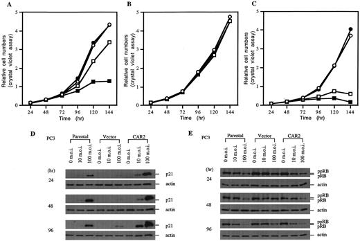 Fig. 1. Increased the efficacy of gene therapy in CAR-expressing prostate cancer. PC3-parental cells, PC3-vector cells, and PC3-CAR2 cells were infected with p21 adenovirus at 0, 1, 10, 100 m.o.i. At the indicated time, total cell number was determined by the crystal violet assay. Protein extracts were analyzed by Western blot analysis with p21- or Rb-specific antibodies. A, growth rate of PC3-parental cells infected with p21 virus; B, growth rate of PC3-vector cells infected with p21 virus. C,growth rate of PC3-CAR2 cells infected with p21 virus; D, expression of exogenous p21 proteins in PC3 cells infected by p21 adenovirus; E, phosphated Rb levels in p21 virus-infected PC3 clones. ppRb, hyperphosphorylated form of Rb; pRb, hypophosphorylated form. ○, control;•, 1 m.o.i.; □, 10 m.o.i.; ▪, 100 m.o.i.