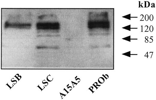 Fig. 4. Western blot analysis of total cell extracts using mAb LM389. Extracts were from clones LSC and LSB derived from the LS174T human colon carcinoma cell line and clone PROb derived from the DHDK12 rat colon carcinoma cell line and rat A15A5 glioma cell line. Molecular weight markers (in thousands; kDa) are indicated.